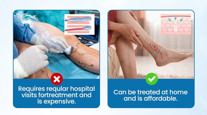 💪Ourlyard® VeinGuard Herbal Spray-✅ Clinically proven to eliminate varicose veins in just 7 days! (🔥Limited Time 80% OFF🔥)