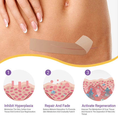 👨‍⚕️Official Store |Ourlyard® Hyaluronic Acid Nano Microneedle Repair Tape🏥(Treatment of old and new scars, reduction of surgical scars, stretch marks, keloids, acne, burns, warts, dermatomes and varicose veins)