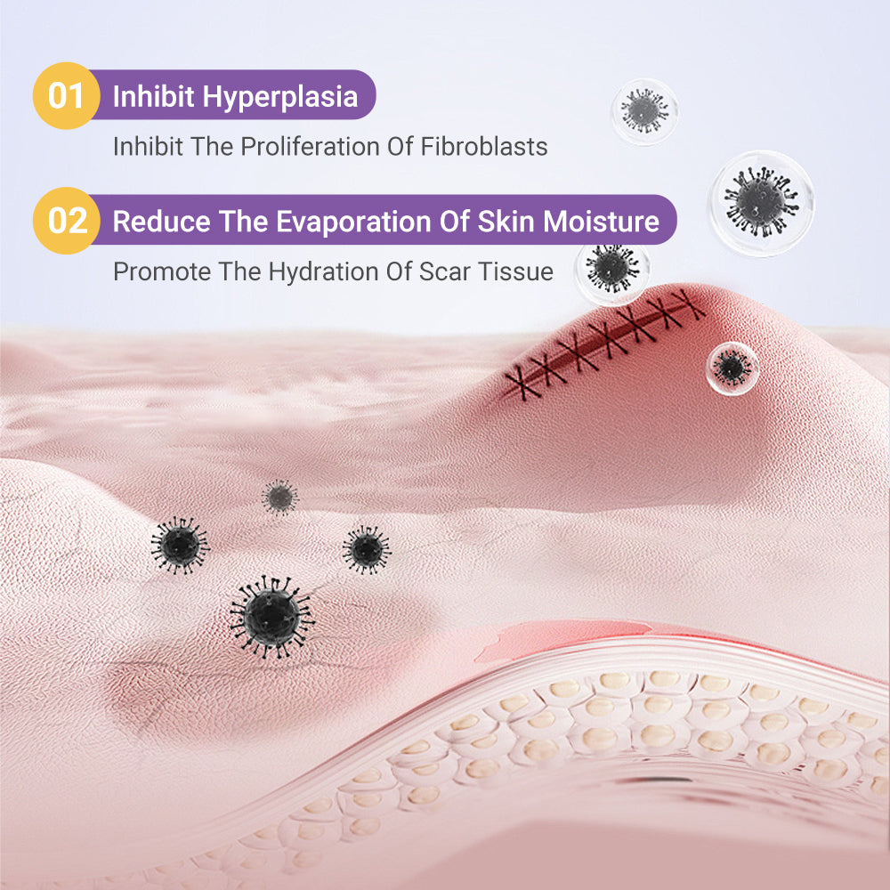👨‍⚕️Official Store |Ourlyard® Hyaluronic Acid Nano Microneedle Repair Tape🏥(Treatment of old and new scars, reduction of surgical scars, stretch marks, keloids, acne, burns, warts, dermatomes and varicose veins)