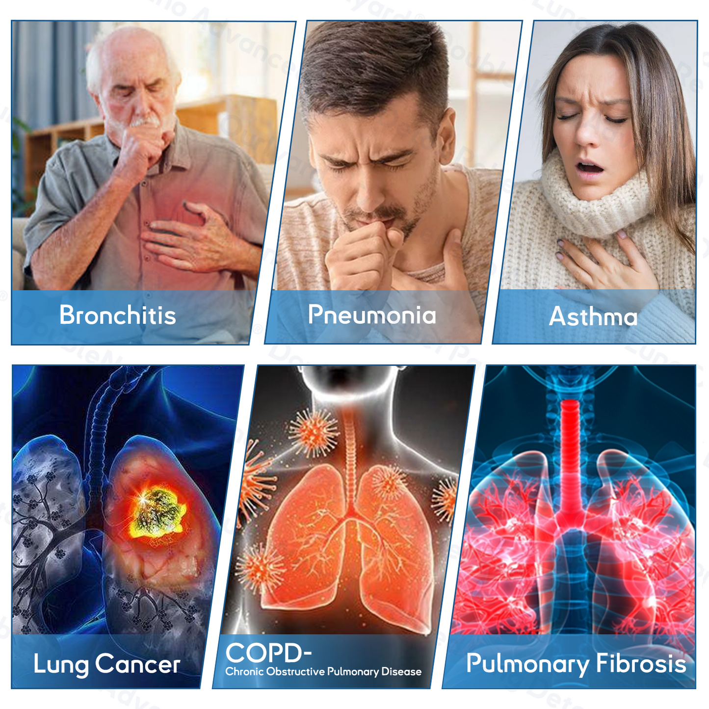 🎁🎁🎁𝐎𝐟𝐟𝐢𝐜𝐢𝐚𝐥 𝐒𝐭𝐨𝐫𝐞: 𝐎𝐮𝐫𝐥𝐲𝐚𝐫𝐝® 𝐃𝐨𝐮𝐛𝐥𝐞𝐍𝐚𝐧𝐨 𝐀𝐝𝐯𝐚𝐧𝐜𝐞𝐝 𝐋𝐮𝐧𝐠 𝐃𝐞𝐭𝐨𝐱 𝐑𝐞𝐥𝐢𝐞𝐟 𝐏𝐚𝐭𝐜𝐡 💝𝗔𝗽𝗽𝗿𝗼𝘃𝗲𝗱 𝗯𝘆 𝗛𝗲𝗮𝗹𝘁𝗵 𝗖𝗮𝗻𝗮𝗱𝗮