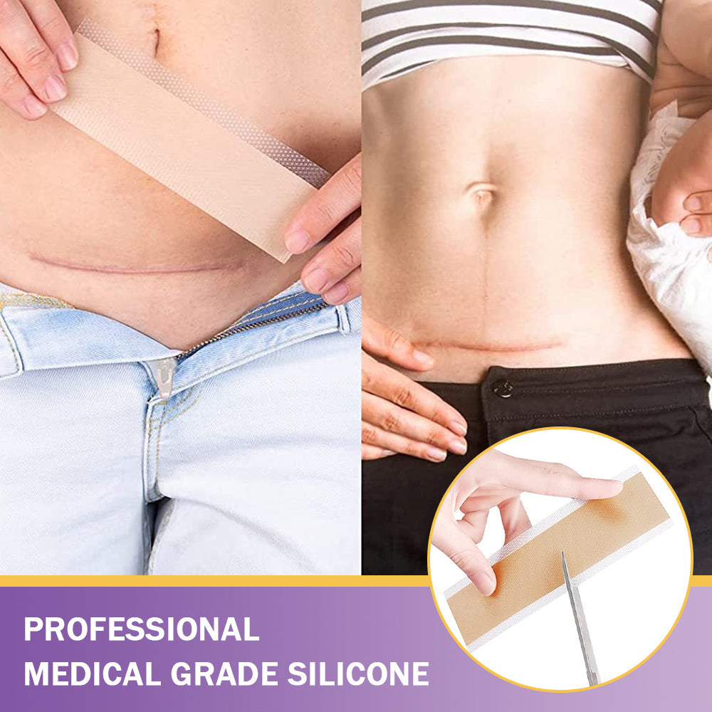 👨‍⚕️Official Store |Ourlyard® Hyaluronic Acid Nano Microneedle Repair Tape🏥(Treatment of old and new scars, reduction of surgical scars, stretch marks, keloids, acne, burns, warts, dermatomes and varicose veins)