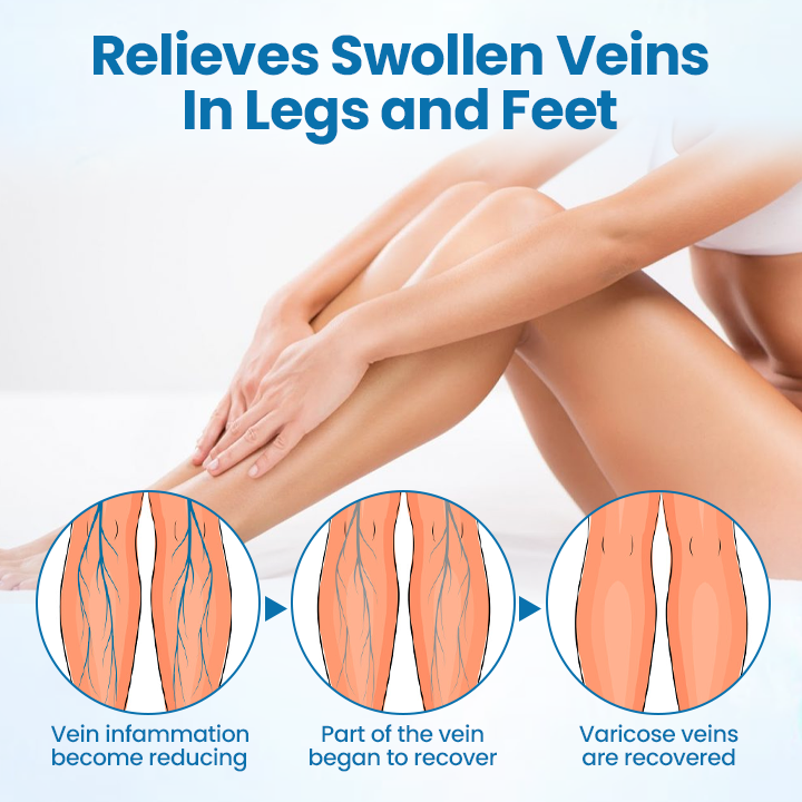 💪Ourlyard® VeinGuard Herbal Spray-✅ Clinically proven to eliminate varicose veins in just 7 days! (🔥Limited Time 80% OFF🔥)