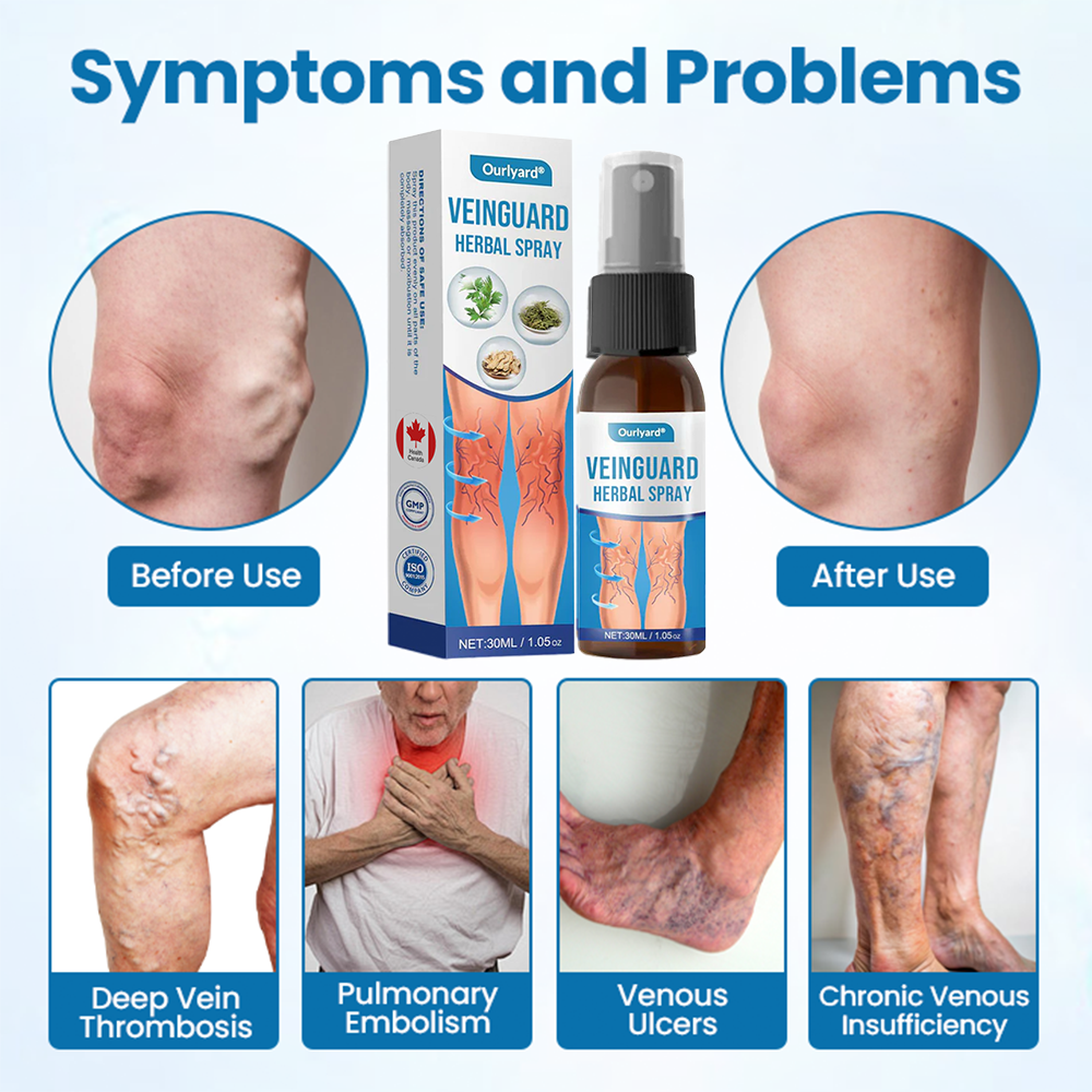 💪Ourlyard® VeinGuard Herbal Spray-✅ Clinically proven to eliminate varicose veins in just 7 days! (🔥Limited Time 80% OFF🔥)