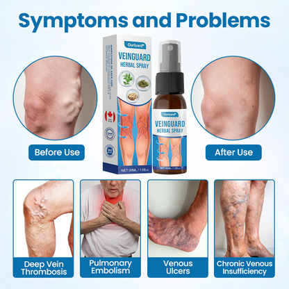 💪Ourlyard® VeinGuard Herbal Spray-✅ Clinically proven to eliminate varicose veins in just 7 days! (🔥Limited Time 80% OFF🔥)